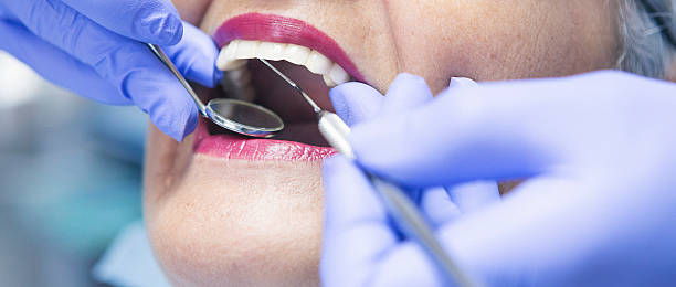 Best Emergency Wisdom Tooth Extraction in East Dubuque, IL
